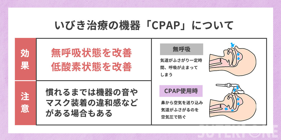 いびき治療の機器CPAPについて