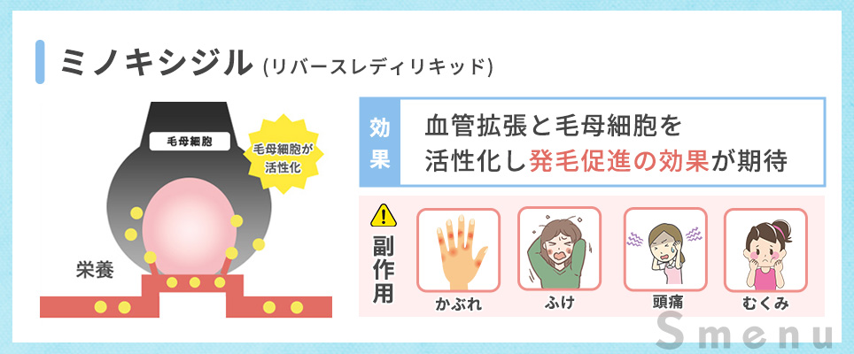 リバースレディタブレットA(ミノキシジル)説明