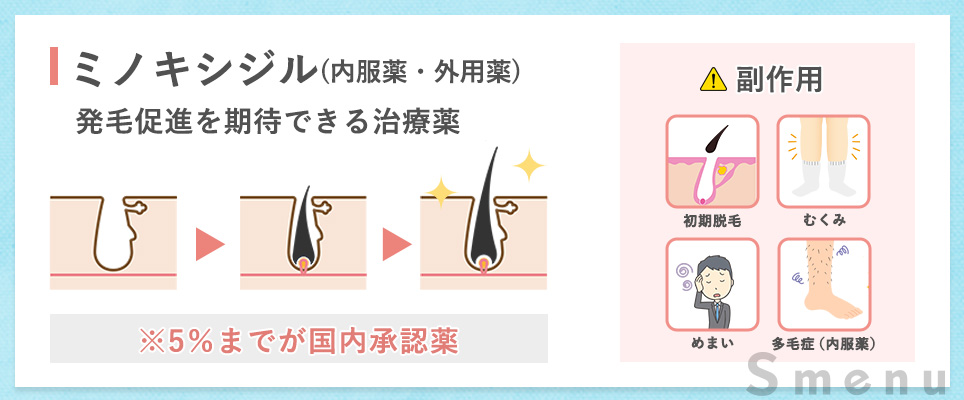 ミノキシジル