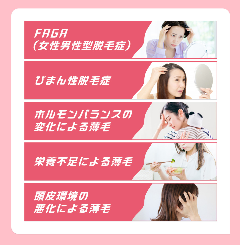 PANTOに効果がある薄毛の症例
