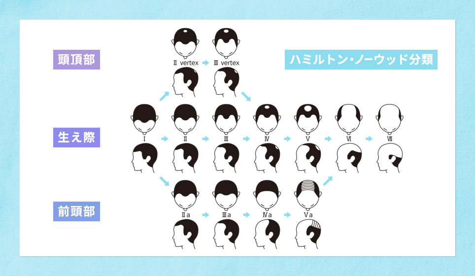 ハミルトン・ノーウッド分類の図説