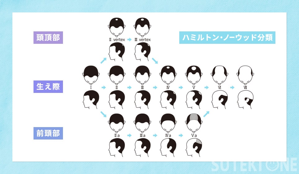 ハミルトンノーウッド分類の図説