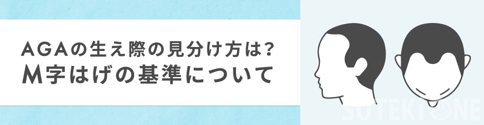M字ハゲの基準