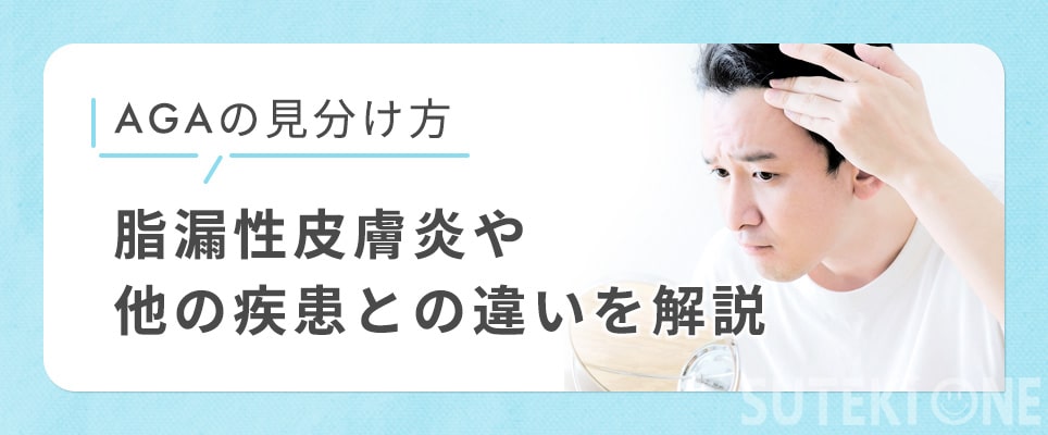 AGAの見分け方！脂漏性皮膚炎などの違いを紹介