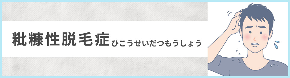 粃糠性脱毛症（ひこうせいだつもうしょう）