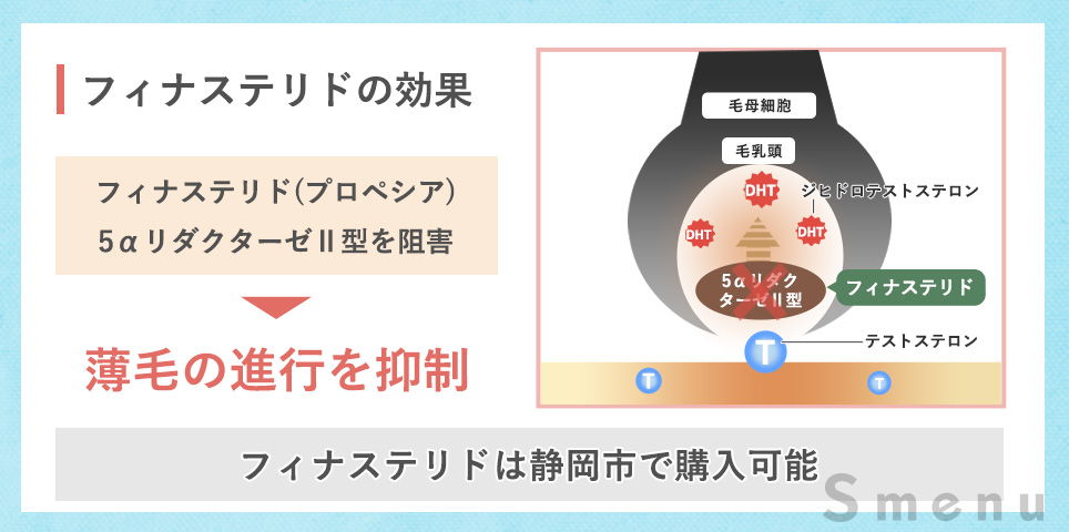 フィナステリドの効果