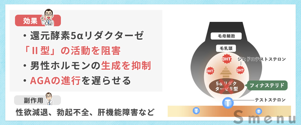 フィナステリド(プロペシア)の仕組みと副作用