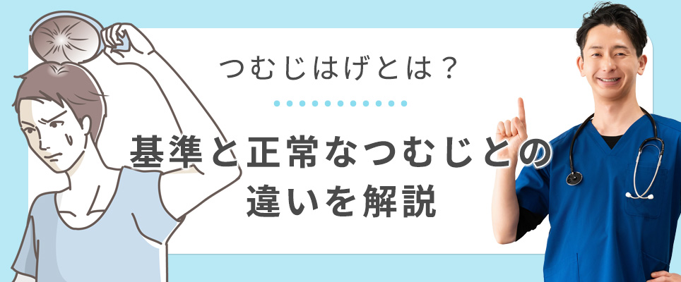 正常なつむじとつむじはげの違い