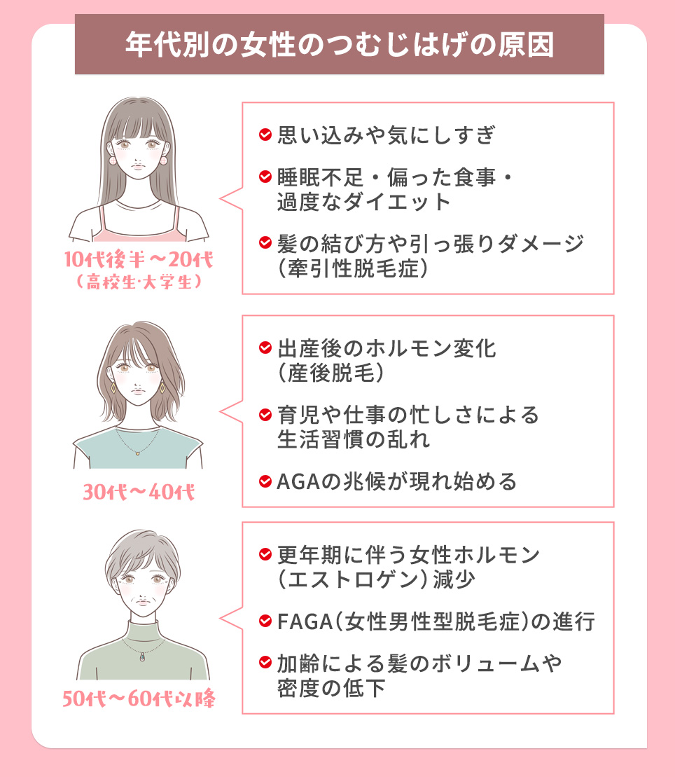 年代別の女性のつむじはげの原因一覧