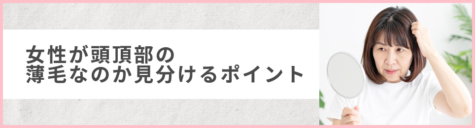 女性が頭頂部の薄毛なのか見分けるポイント